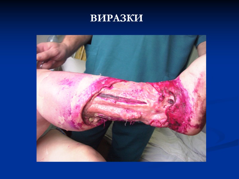 ВИРАЗКИ ВИРАЗКИ